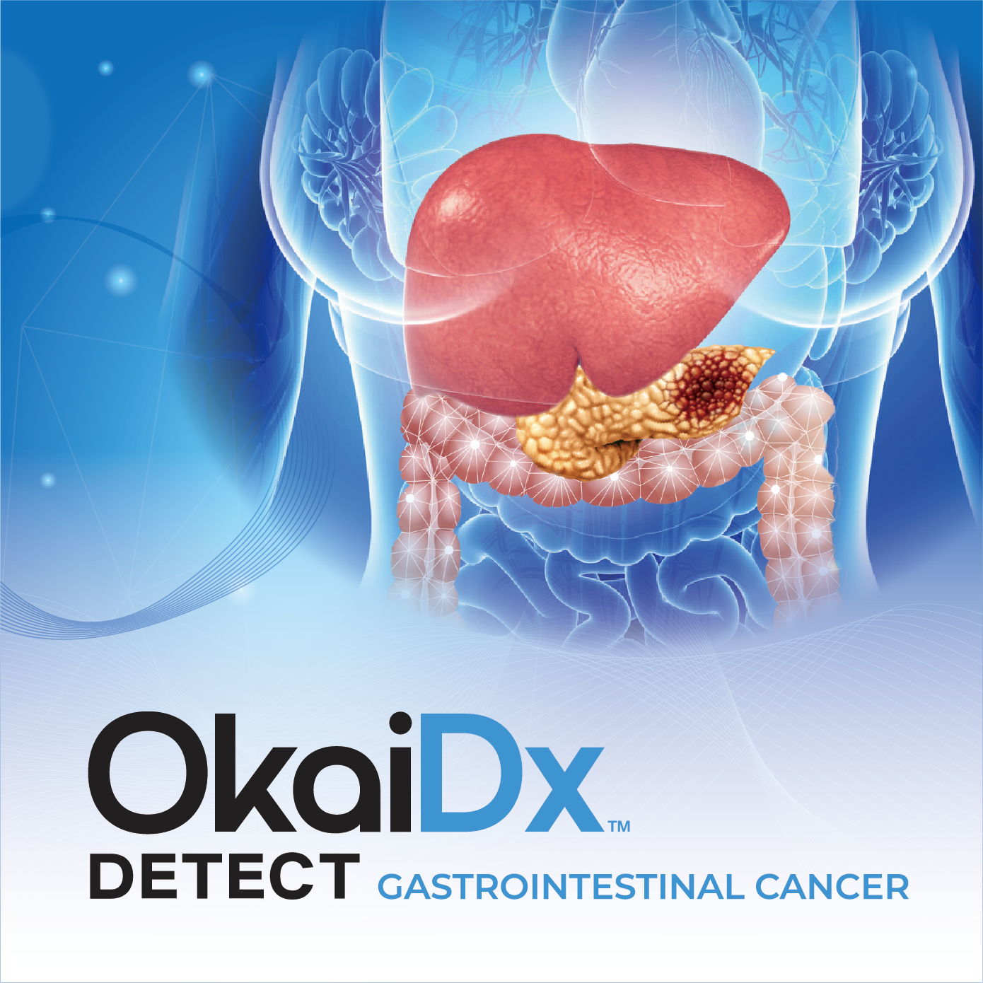 OkaiDx Gastrointestinal Cancer Detection Blood Test